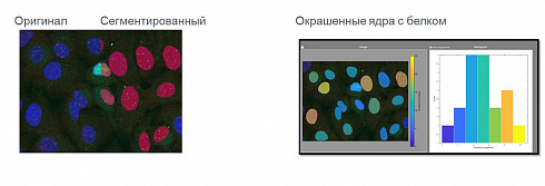 Автоматический подсчет FISH – сигналов в ядрах клеток